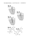 Biological Unit Removal Tools and Methods diagram and image