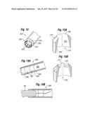 Biological Unit Removal Tools and Methods diagram and image