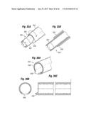 Biological Unit Removal Tools and Methods diagram and image