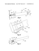 TISSUE APPOSITION CLIP APPLICATION METHODS diagram and image