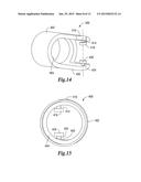 TISSUE APPOSITION CLIP APPLICATION METHODS diagram and image