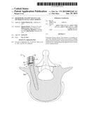 Orthopedic Fixation Devices and Methods of Installation Thereof diagram and image