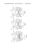 Orthopedic Fixation Devices and Methods of Installation Thereof diagram and image