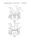 Orthopedic Fixation Devices and Methods of Installation Thereof diagram and image