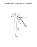 GROWTH CONTROL DEVICE diagram and image