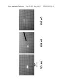 METHODS AND APPARATUS FOR OMNIDIRECTIONAL TISSUE ILLUMINATION diagram and image