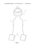 DESENSITIZING DEVICE diagram and image