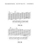 BIOABSORBABLE POLYMERIC MEDICAL DEVICE diagram and image