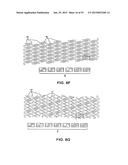 BIOABSORBABLE POLYMERIC MEDICAL DEVICE diagram and image