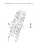 BIOABSORBABLE POLYMERIC MEDICAL DEVICE diagram and image