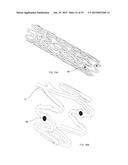 BIOABSORBABLE POLYMERIC MEDICAL DEVICE diagram and image