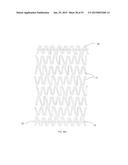 BIOABSORBABLE POLYMERIC MEDICAL DEVICE diagram and image