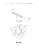 BIOABSORBABLE POLYMERIC MEDICAL DEVICE diagram and image