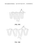 BIOABSORBABLE POLYMERIC MEDICAL DEVICE diagram and image