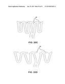 BIOABSORBABLE POLYMERIC MEDICAL DEVICE diagram and image