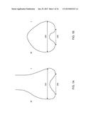 Patient-Adapted Posterior Stabilized Knee Implants, Designs and Related     Methods and Tools diagram and image