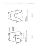 Patient-Adapted Posterior Stabilized Knee Implants, Designs and Related     Methods and Tools diagram and image