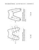 Patient-Adapted Posterior Stabilized Knee Implants, Designs and Related     Methods and Tools diagram and image