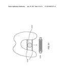 Patient-Adapted Posterior Stabilized Knee Implants, Designs and Related     Methods and Tools diagram and image