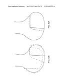 Patient-Adapted Posterior Stabilized Knee Implants, Designs and Related     Methods and Tools diagram and image