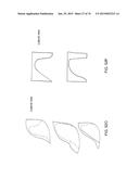 Patient-Adapted Posterior Stabilized Knee Implants, Designs and Related     Methods and Tools diagram and image