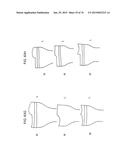 Patient-Adapted Posterior Stabilized Knee Implants, Designs and Related     Methods and Tools diagram and image