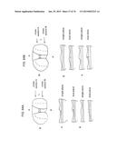 Patient-Adapted Posterior Stabilized Knee Implants, Designs and Related     Methods and Tools diagram and image