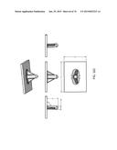 Patient-Adapted Posterior Stabilized Knee Implants, Designs and Related     Methods and Tools diagram and image