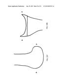 Patient-Adapted Posterior Stabilized Knee Implants, Designs and Related     Methods and Tools diagram and image