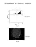 SYSTEMS AND METHODS FOR SELECTING AND ANALYZING PARTICLES IN A BIOLOGICAL     TISSUE diagram and image