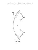 Dorsal Wear-Pad diagram and image