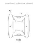 Dorsal Wear-Pad diagram and image