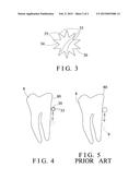 TOOTHBRUSH BRISTLE ELEMENT HAVING SERRATED OUTER STRUCTURE diagram and image