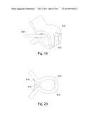 CABLE MANAGEMENT APPARATUS AND METHOD diagram and image