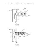 HYBRID BALLOON-EXPANDABLE/SELF-EXPANDING PROSTHESIS FOR DEPLOYMENT IN A     BODY VESSEL AND METHOD OF MAKING diagram and image