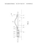 CENTRALIZER diagram and image