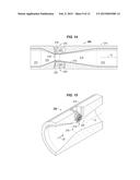 Moveable Element to Create Pressure Signals in A Fluidic Modulator diagram and image