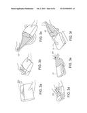 DUAL LAYER WRAP PACKAGE FOR ASEPTIC PRESENTATION diagram and image