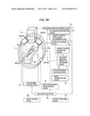 RADIOTHERAPY SYSTEM diagram and image