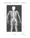 MEASURING INTRAMUSCULAR FAT diagram and image