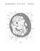 MEASURING INTRAMUSCULAR FAT diagram and image