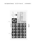 INTERACTIVE OPTIMIZATION OF SCAN DATABASES FOR STATISTICAL TESTING diagram and image