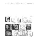 Methods of Modulating Smooth Muscle Cell Proliferation and Differentiation diagram and image