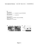 Methods of Modulating Smooth Muscle Cell Proliferation and Differentiation diagram and image