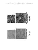 TECHNOLOGIES FOR PANCREATIC ISLET TRANSPLANTATION diagram and image