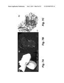 TECHNOLOGIES FOR PANCREATIC ISLET TRANSPLANTATION diagram and image