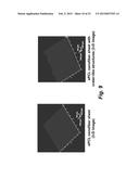 TECHNOLOGIES FOR PANCREATIC ISLET TRANSPLANTATION diagram and image