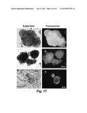 TECHNOLOGIES FOR PANCREATIC ISLET TRANSPLANTATION diagram and image