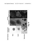 TECHNOLOGIES FOR PANCREATIC ISLET TRANSPLANTATION diagram and image