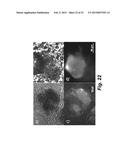 TECHNOLOGIES FOR PANCREATIC ISLET TRANSPLANTATION diagram and image